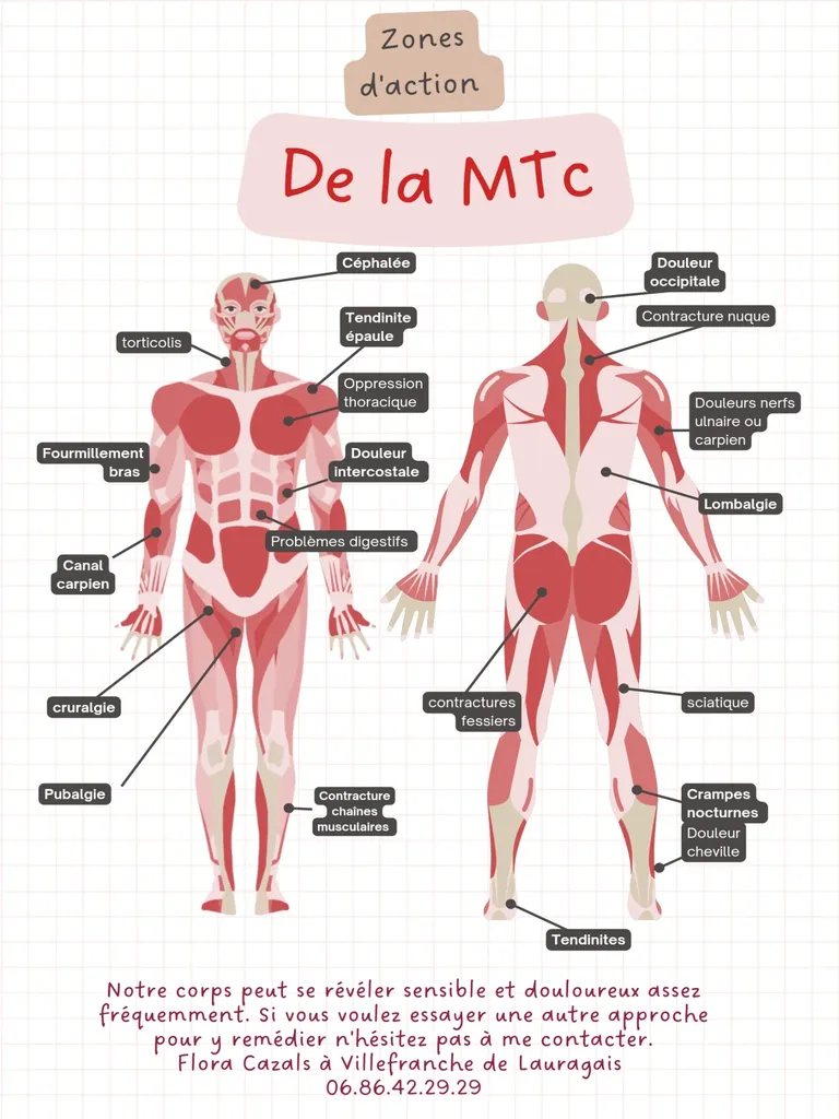Zones d'action de la méthode traditionnelle chinoise : céphalées, torticolis, tendinites de l'épaule, douleurs intercostales, problèmes digestifs, canal carpien, lombalgies, sciatique, cruralgie, crampes nocturnes, tendinites